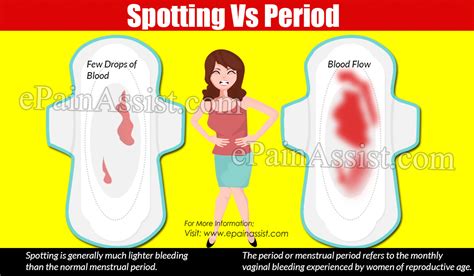 Difference Between Pregnancy Spotting And Period Spotting Vs Period