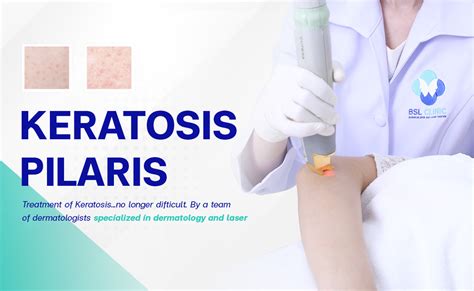 Keratosis Pilaris And Pseudo Folliculitis Bangkok Aesthetic Clinic