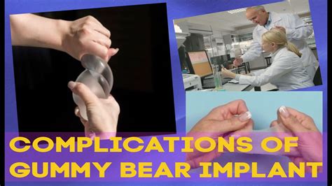 Gummy Bear Implant Complications Youtube
