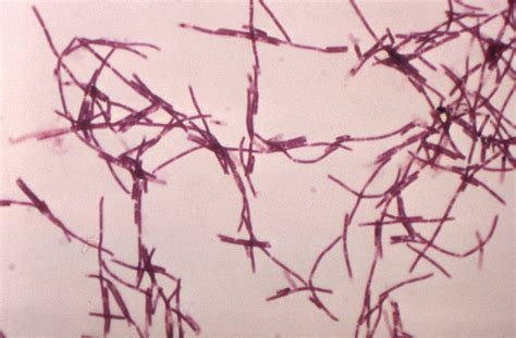 Figure Anthrax Bacillus Anthracis Gram Positive Rods