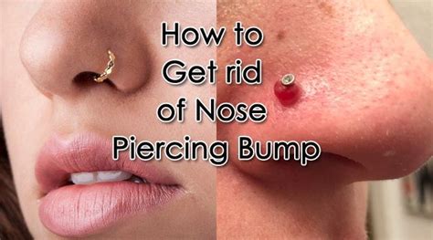 How To Get Rid Of Nose Piercing Bump Nose Piercing Nose Piercing