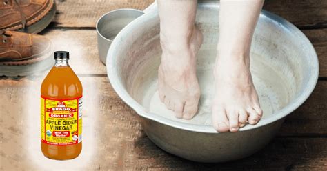 Detoxify And Heal The Body With This Apple Cider Vinegar Detox Foot