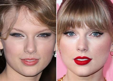 Taylor Swifts Plastic Surgery Has Taylor Swift Undergone Cosmetic Procedures Bss News