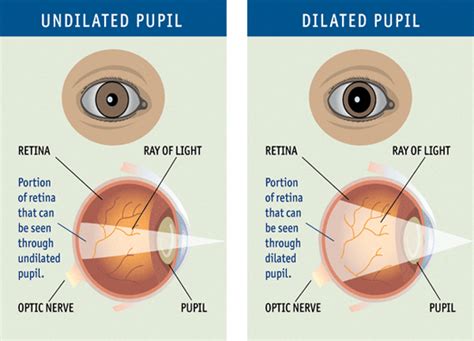 What Is A Comprehensive Dilated Eye Exam Optometrist Eye Doctor In