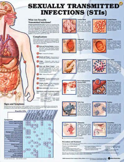 Sexually Transmitted Infections Chart 20x26 Top Nursing Schools
