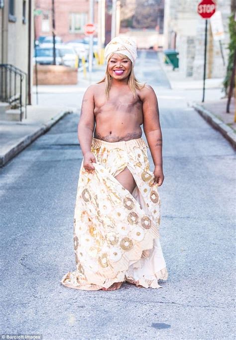 Breast Cancer Survivor Proudly Shows Off Her Double Mastectomy Scars