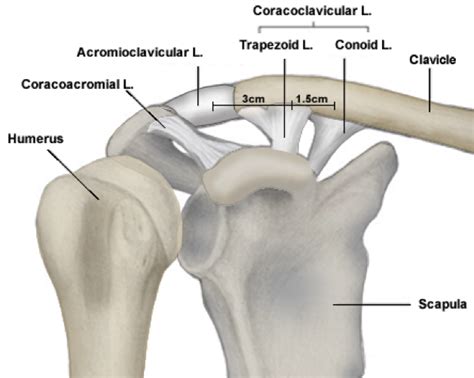 Acromioclavicular Ac Joint Separations — Andrew Dold Md Orthopedic