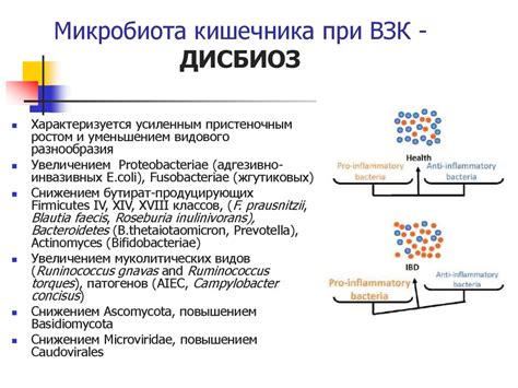 Микрофлора кишечника рассеянный склероз фото презентация