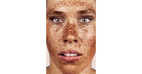 Photos Of People With Freckles Popsugar Beauty Photo 9