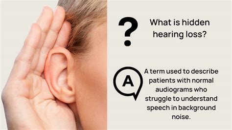 What Is Hidden Hearing Loss