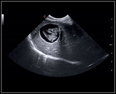 Veterinary Ultrasound Diagnostic Imaging Clinical Images Search Esaote