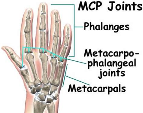 Metacarpophalangeal Mp Or Mcp Joint Anatomy Samarpan