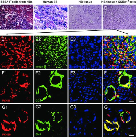 Tumor formation in nude mice injected with sorted SSEA1þ cells from