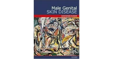 Male Genital Skin Disease By Chris Bunker