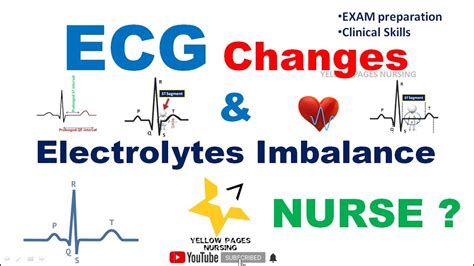 ECG Changes In Electrolyte Imbalance YouTube