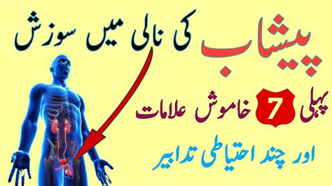 Peshab Ki Nali Ka Infection Urine Infection Treatment In Urdu Peshab Ki Nali Main Sozish Ka