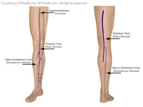 Femur, upper bone of the leg or hind leg. Leg Vein Anatomy 101