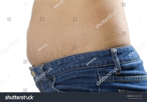 stretch mark on mature woman stomach foto stock 100825039 shutterstock