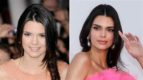 Kardashian Jenner Sisters Who Has Had The Most Plastic Surgery