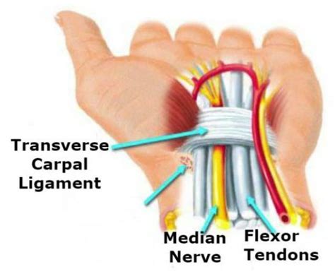 Carpal Tunnel Syndrome Here S What You Need To Know Liebscher Bracht