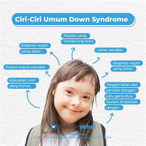 Doktersehat Down Syndrome Adalah Kelainan Genetik Yang