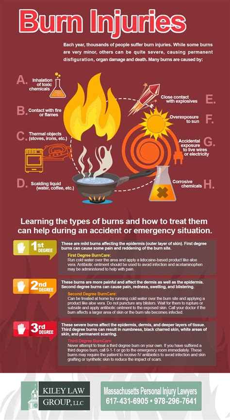 Burn Injury Infographic From The Kiley Law Group An Injury Law Firm In