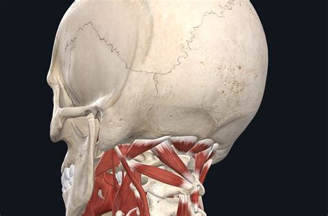 Suboccipital Muscles And Headaches Physiostrength