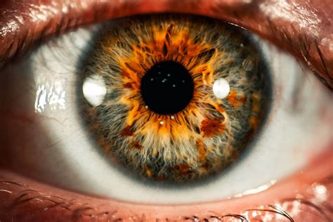 What Is A Recurrent Corneal Erosion And How Is It Treated Neal Eye Group
