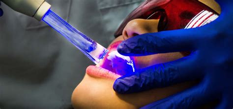 How Laser Dentistry Can Help Your Smile - Gateway Oaks Dental