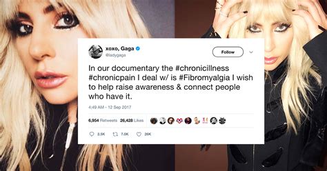 Lady Gaga Fibromyalgia Fibro Warriors Send Get Well Wishes After Big Reveal