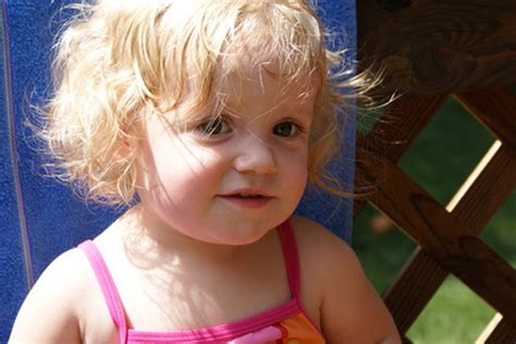 How to Treat Severely Dry Scalp in Toddlers | Livestrong.com