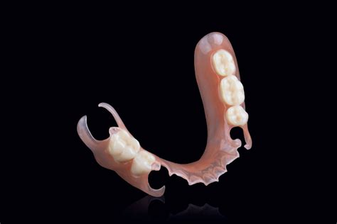flexible partials — modern dental