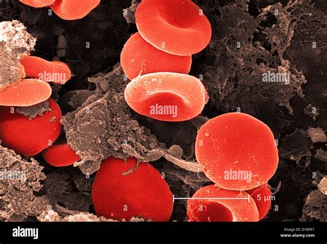 Electron Micrograph Of Red Blood Cells And Fibrin Stock Photo Alamy