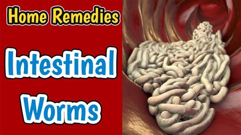Natural Treatment For Intestinal Worms Herbs For Parasites Home Remedies For Stomach Worms