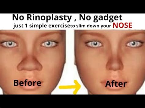 how to lose nose fat new product review articles offers and buying assistance