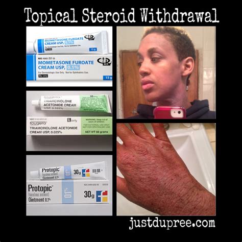 Topical Steroid Withdrawal Topical Steroid Addiction Red Skin