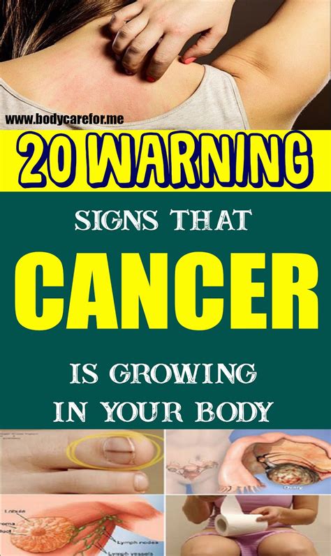 20 Warning Signs That Cancer Is Growing In Your Body Natural Beauty