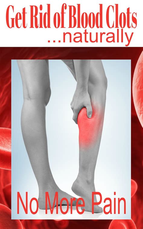 Understand And Get Rid Of Blood Clots Love Home And Health