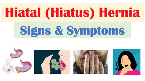 Hiatal Hiatus Hernia Signs Symptoms Why They Occur Youtube