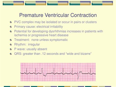 Premature Ventricular Contractions Treatment One Treatment
