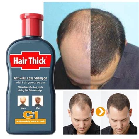 Hair Growth 100ml Anti Hair Loss Shampoo Thick Genzproduct