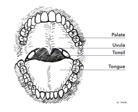 Tonsillectomy In Adults Ent Specialist Adelaide Paul Varley Ent