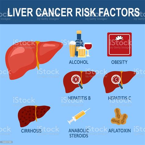 Liver Cancer Risk Factors Infographic Vector Illustration Stock