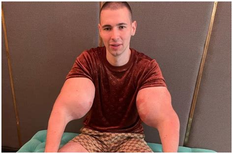 Man With Popeye Arms Desperate To Get Rid Of The Muscles That Could