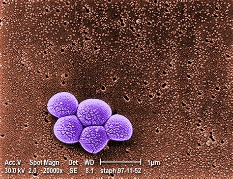 Staphylococcus Aureus Mrsa 中文 Continen