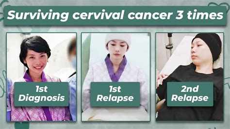 Surviving Cervical Cancer 3 Times In My 20s Summers Story Youtube