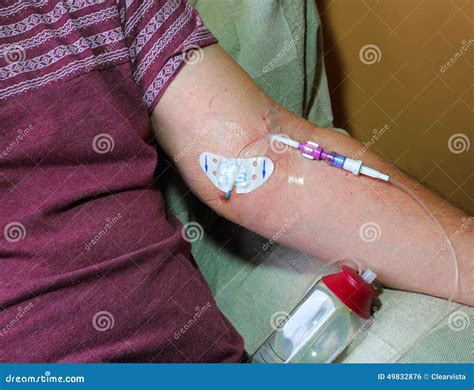 Cancer Patient Chemotherapy Picc Line Therapy Stock Photo Image