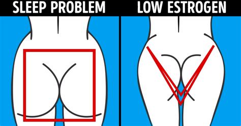 What The Shape Of Your Buttocks Reveals About Your Health