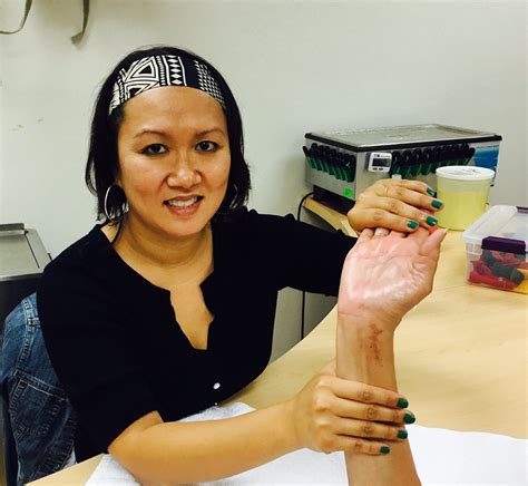 How Occupational Therapy Can Help After A Wrist Fracture Hands On