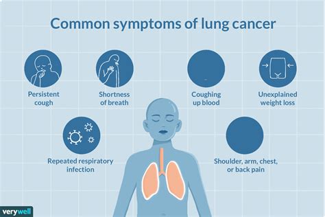 Signs And Symptoms Of Lung Cancer Cough Phlegm Mucus